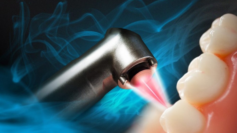 Choice Dental laser surgery in Ikeja
