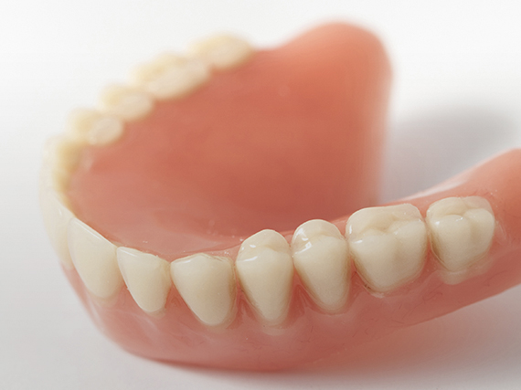 Dentures in ikeja, lagos