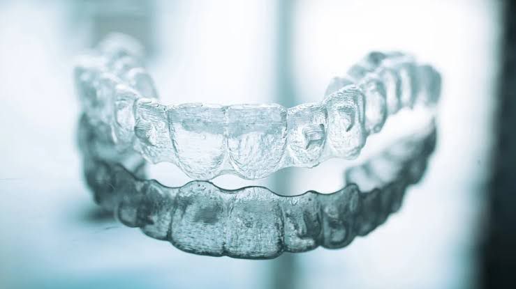 Get Invisalign in Ikeja