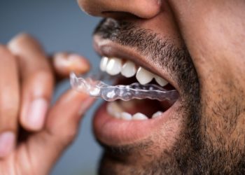 Get an affordable Invisalign in Ikeja Lagos
